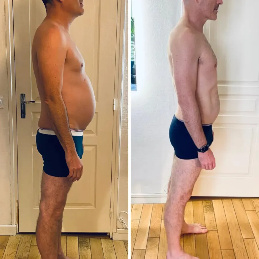 Transformation avant / après de Frédéric